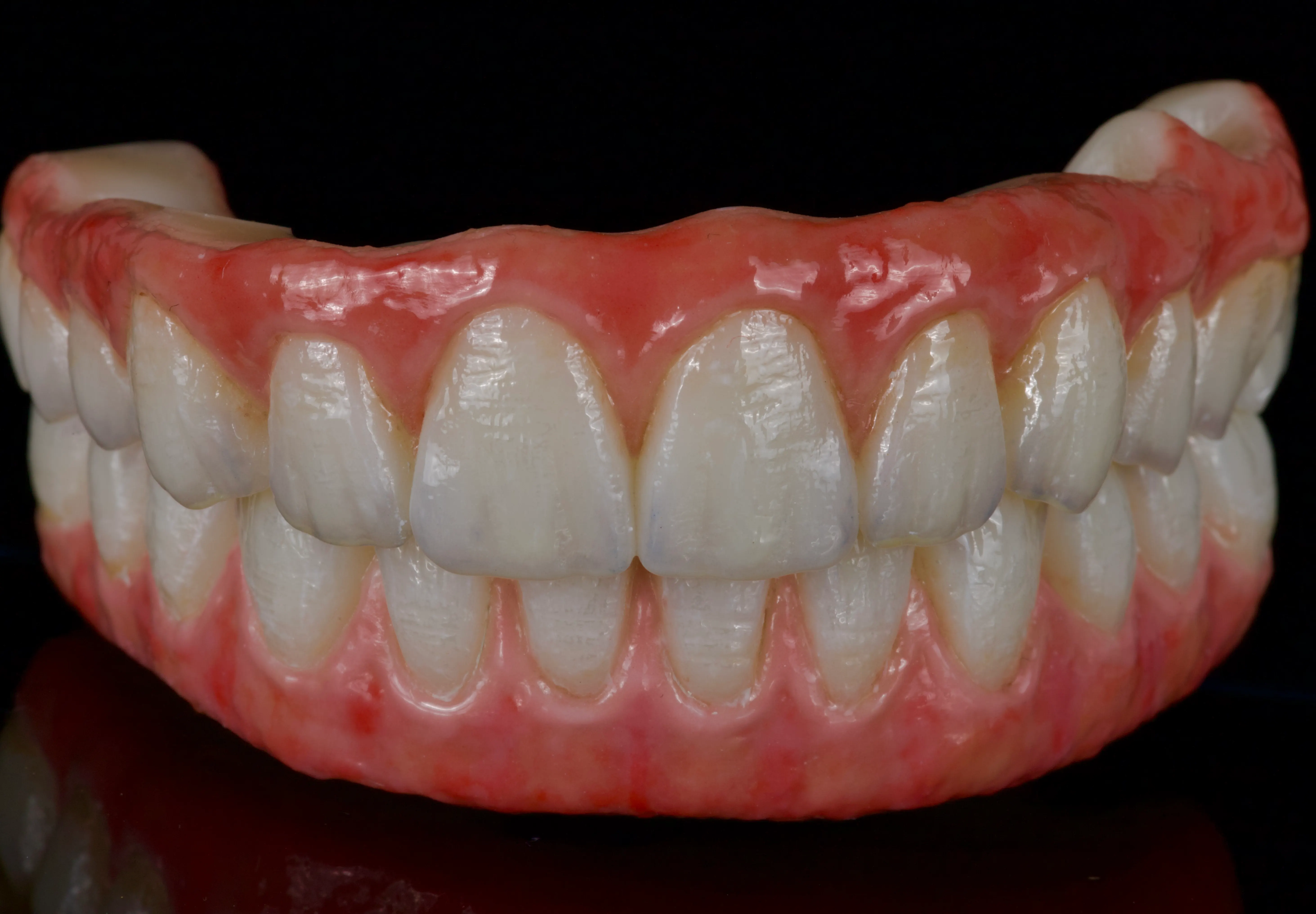 100% Zirconia final teeth